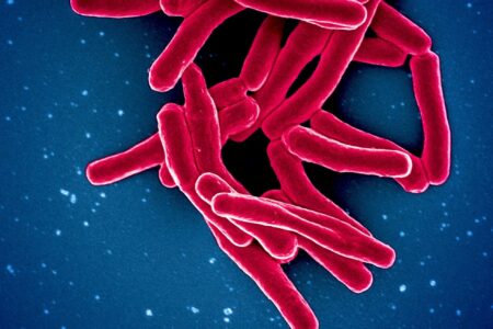Người nhiễm HIV cần làm gì để phòng tránh lao tái phát?