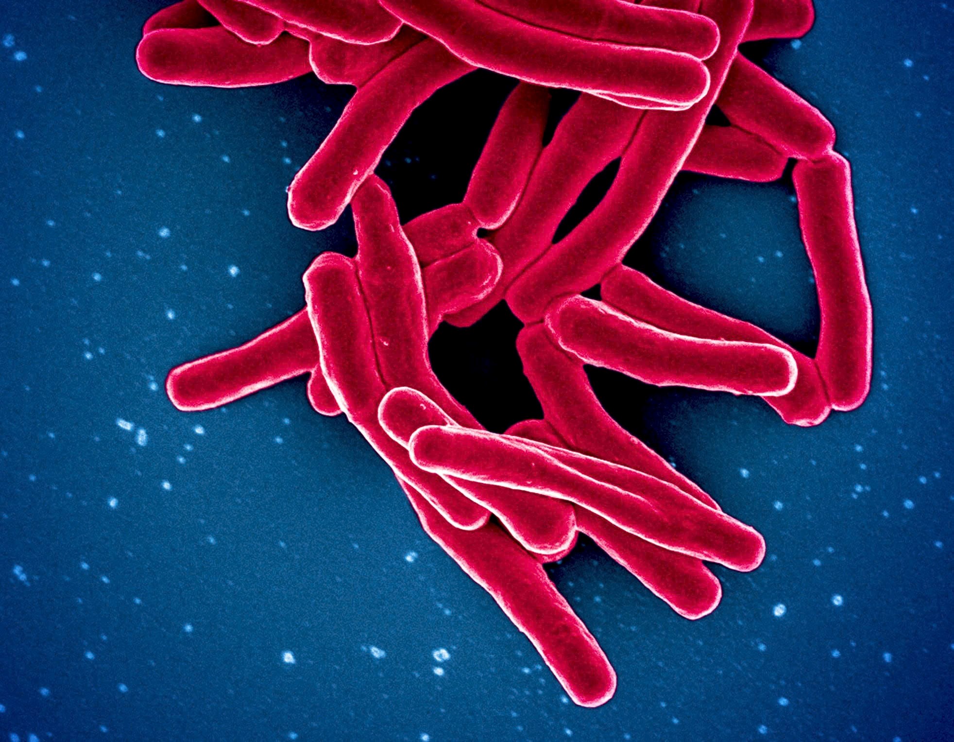 Người nhiễm HIV cần làm gì để phòng tránh lao tái phát?